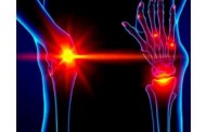 Лазеротерапия при артрозе: обзор метода, который часто обсуждают в кабинетах физиотерапии