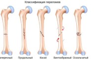 Очарование рукокрылых: Тайны мира летучих мышей
