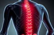 Поясничный остеохондроз: жалобы и обследование без лишних догадок