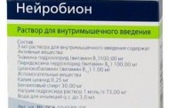 Нейробион — действенный препарат от невралгии
