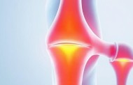 Кальцинаты в сухожилиях: почему болит и что с этим делать