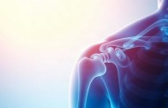 Привычный вывих плеча: причины и операция без лишних страхов