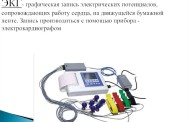 Что представляет собой аппарат ЭКГ?