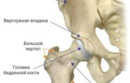Причины появления болей в Тазобедренном суставе и методы лечения
