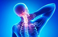 Какие бывают степени остеохондроза шеи?