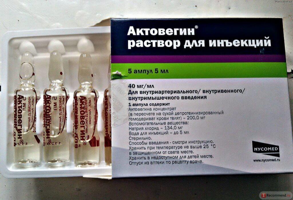 Сосудорасширяющие препараты при остеохондрозе шеи, для головного мозга