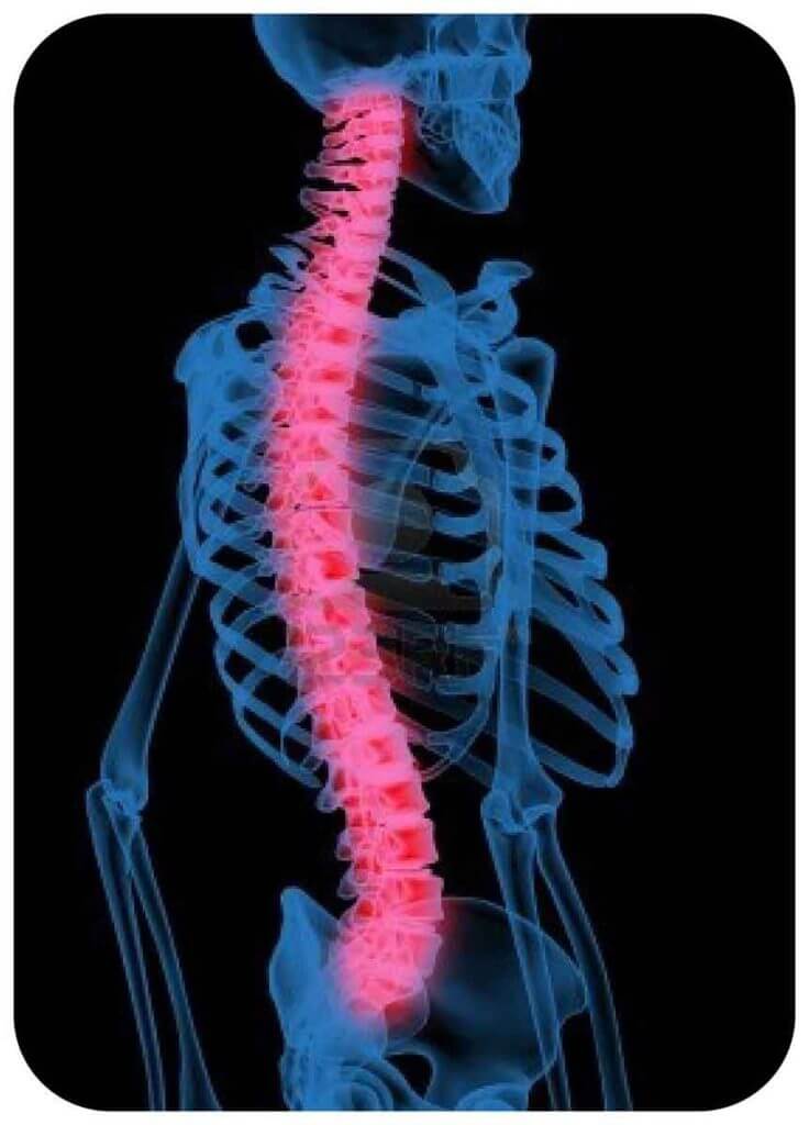 Хондропротекторы для суставов нового поколения, список препаратов ...