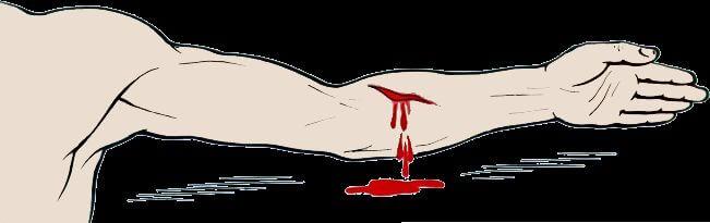 ΠΡΠΎΠ²ΠΎΡΠ΅ΡΠ΅Π½ΠΈΠ΅