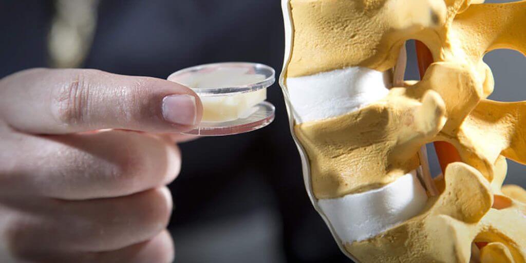 Хондропротекторы для суставов нового поколения, список препаратов ...