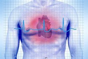 Остановка сердца