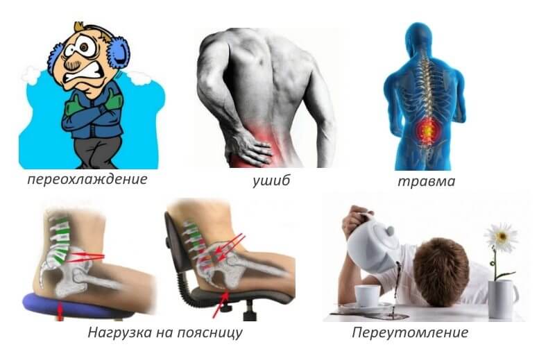 Причины болей в спине