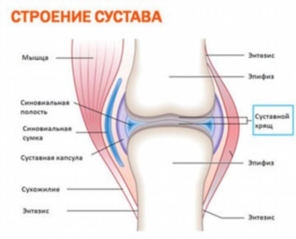 Выпот синовиальной жидкости из сустава. Расшифровка МРТ коленного сустава. Разрастание внутренней выстилки. Синовиальная жидкость: что это, состав, функции, как вырабатывается и. Как лечить артроз суставов: рекомендации для всех возрастов