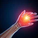 Современные методы лечения артрита: как вернуть радость движения