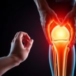 Лечение остеоартроза: Как вернуть подвижность и качество жизни